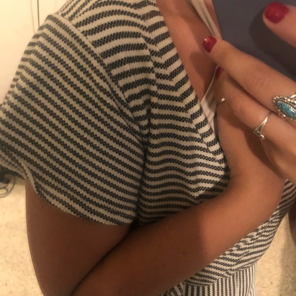 Striped romper - Picture 6 of 6
